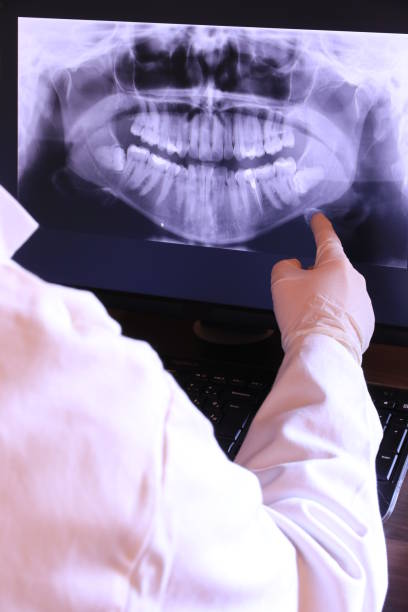 Best Emergency Root Canal Treatment in Belpre, OH